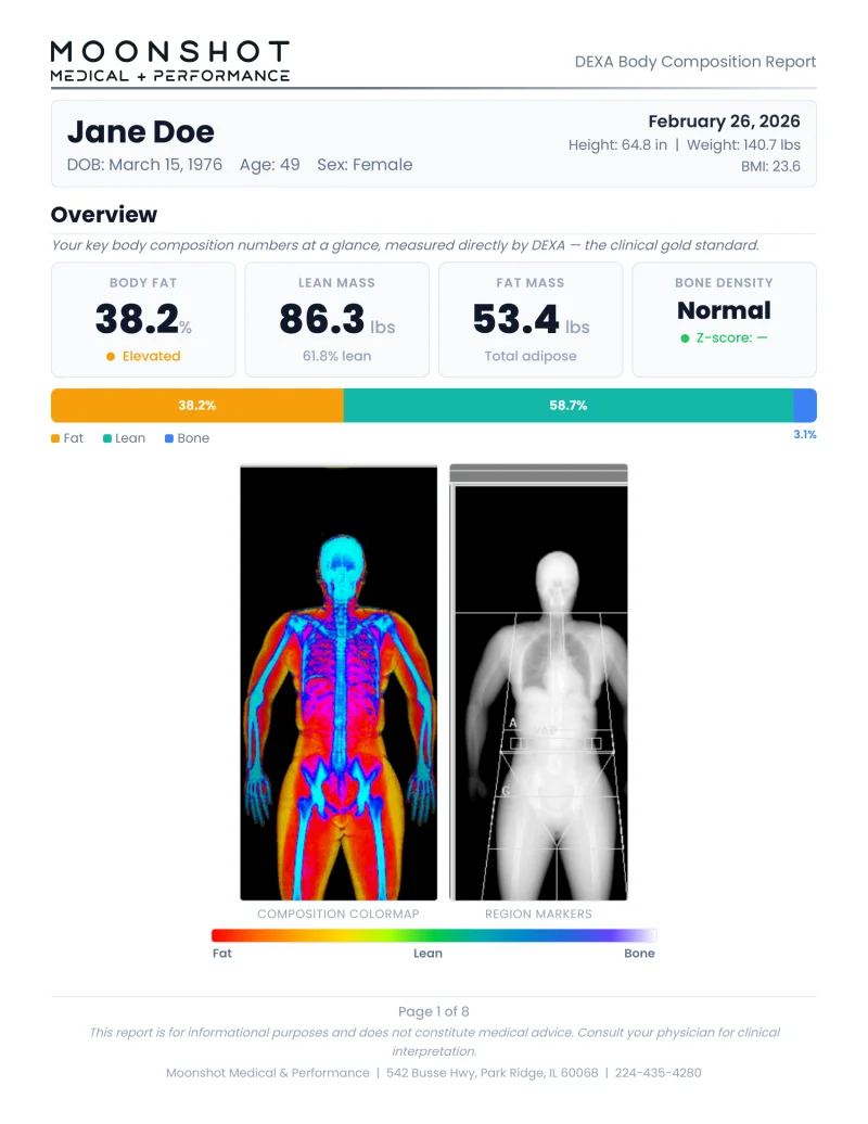 Sample Moonshot DEXA body composition report